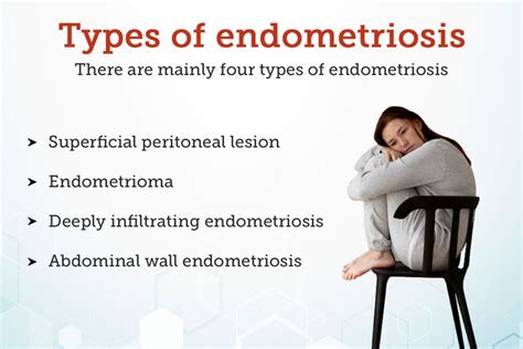 fulguration of endometriosis definition